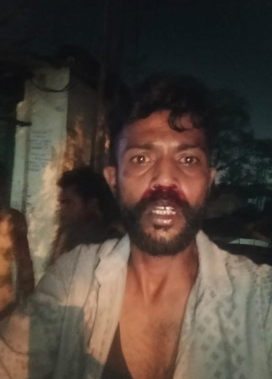 रायपुर में नशे में धुत युवकों का आतंक — विधानसभा रोड आमसीवनी में चाय ठेले संचालक पर हमला, 5000 रुपये लूटे