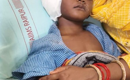 राष्ट्रीय बाल स्वास्थ्य कार्यक्रम (चिरायु) का असर: जन्मजात बधिरता से जूझ रहे तीन बच्चों का अखिल भारतीय आयुर्विज्ञान संस्थान, रायपुर में सफल कॉक्लियर इंप्लांट