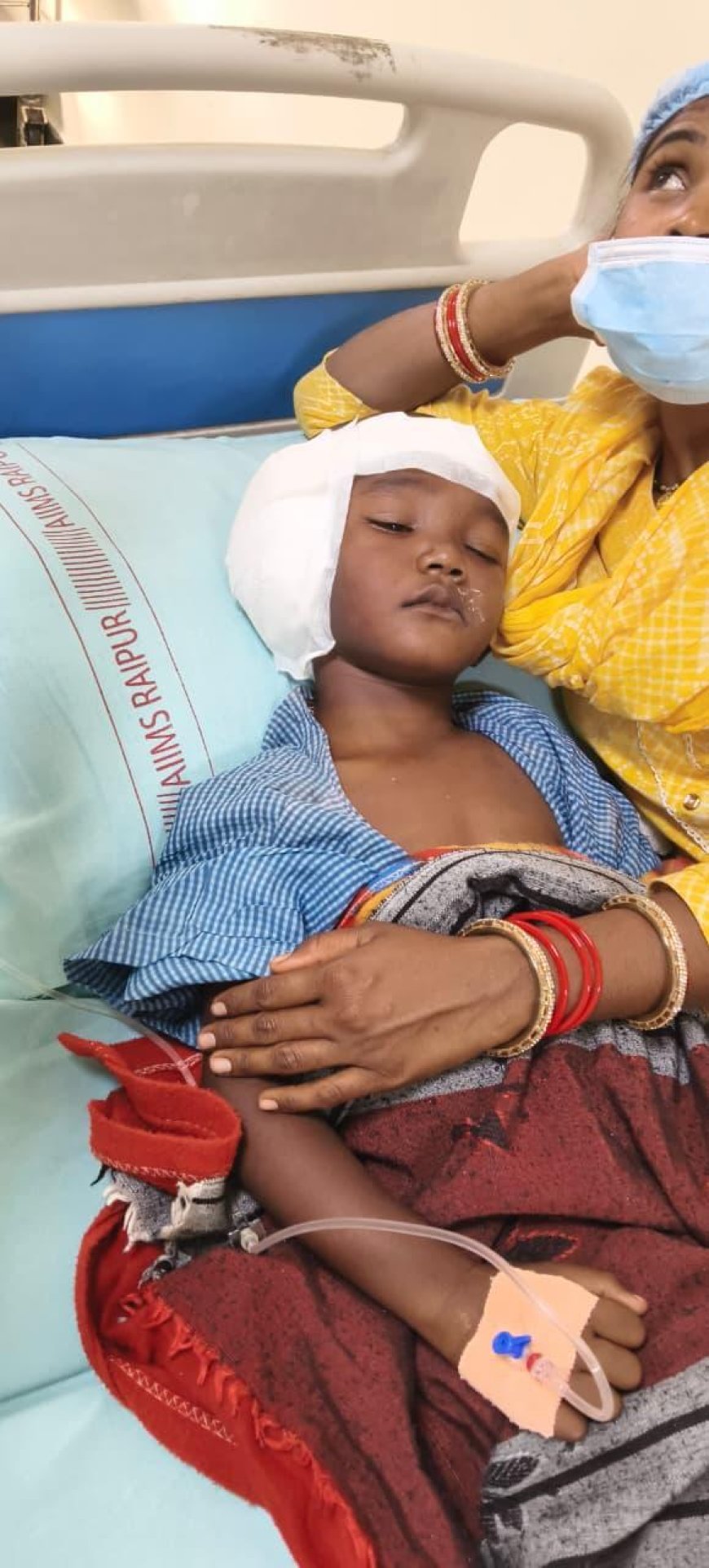 राष्ट्रीय बाल स्वास्थ्य कार्यक्रम (चिरायु) का असर: जन्मजात बधिरता से जूझ रहे तीन बच्चों का अखिल भारतीय आयुर्विज्ञान संस्थान, रायपुर में सफल कॉक्लियर इंप्लांट