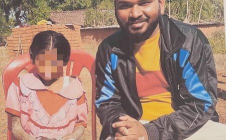 पत्थर शरीर वाली बच्ची के उपचार के लिए बाल आयोग सक्रिय, सहायता राशि की जांच और वितरण प्रक्रिया तेज