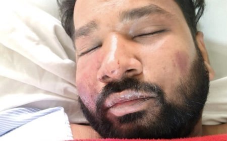 कोरबा में आधी रात खूनी तांडव: ASI के बेटे को बोलेरो से कुचला, पत्रकार का अपहरण कर बेरहमी से पीटा, फायरिंग और लूट की वारदात