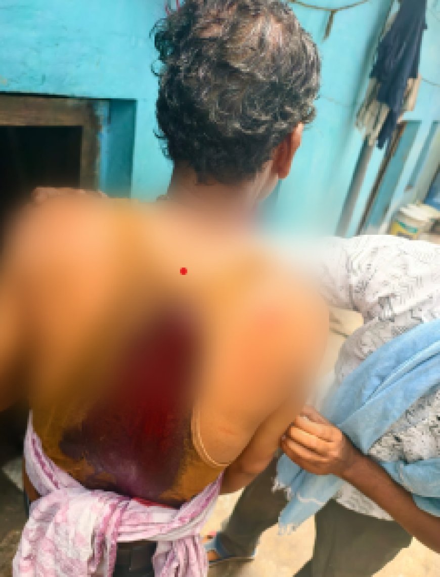 बिलासपुर में चाकूबाजी की वारदात: विवाह से इनकार के बाद युवती के पिता पर हमला, जांच में जुटी पुलिस