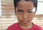रायपुर के राय पब्लिक स्कूल में बड़ा हादसा, चौथी कक्षा के छात्र पर गिरा पंखा