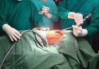 सिम्स बिलासपुर में पहली बार VATS तकनीक से टीबी जनित प्लूरल इफ्यूजन का सफल उपचार