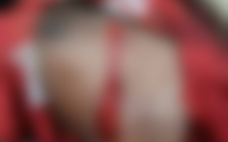 भिलाई में युवक पर कटर से जानलेवा हमला, पैसे के विवाद में पांच आरोपियों की तलाश