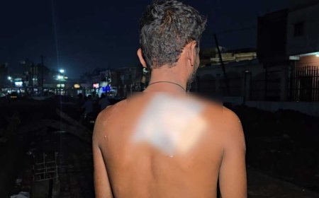 बिरगांव में फिर चाकूबाजी, ठेकेदार पर जानलेवा हमला, लूट की कोशिश से दहशत