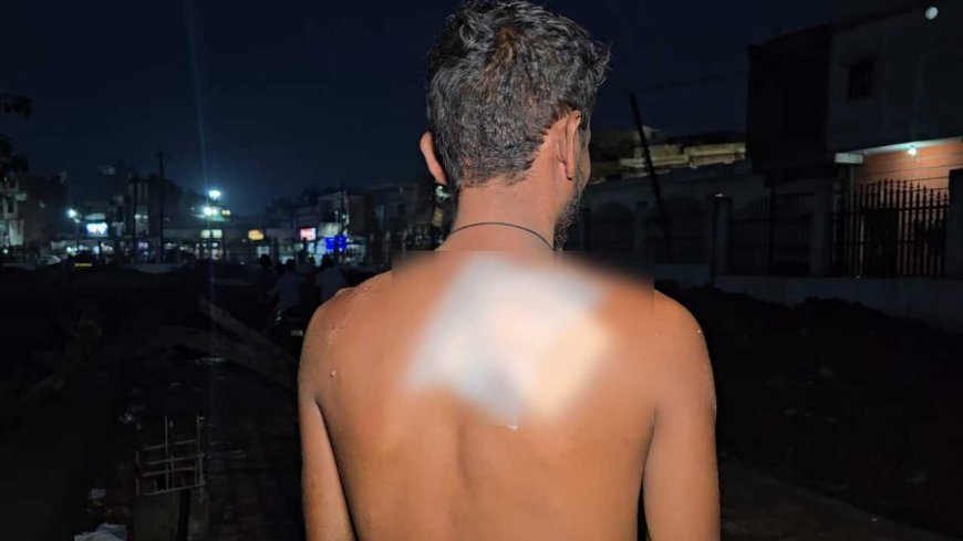 बिरगांव में फिर चाकूबाजी, ठेकेदार पर जानलेवा हमला, लूट की कोशिश से दहशत
