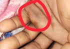 सर्पदंश से वृद्ध की मौत, कबीरधाम पुलिस ने बरसात में सतर्क रहने की अपील की