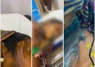 दुर्ग में कांवड़ यात्रा पर निकली महिला पर एसिड अटैक, चेहरा झुलसा; दो बच्चे भी चपेट में