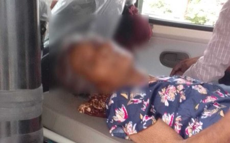 रतलाम हादसे में घायल चिरमिरी की बुजुर्ग महिला को स्वास्थ्य मंत्री श्यामबिहारी जायसवाल की पहल से मिला बेहतर इलाज