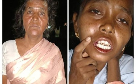 रायपुर के इंद्रप्रस्थ BSUP कॉलोनी में महिला और उसकी मां से मारपीट का आरोप