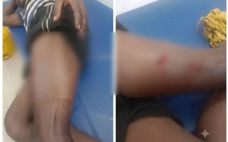 मरवाही में भालू का आतंक, अलग-अलग घटनाओं में तीन लोगों पर हमला; एक बच्चे ने गड्ढे में कूदकर बचाई जान