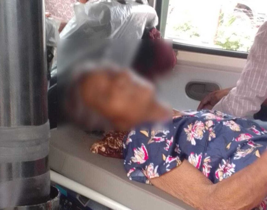 रतलाम हादसे में घायल चिरमिरी की बुजुर्ग महिला को स्वास्थ्य मंत्री श्यामबिहारी जायसवाल की पहल से मिला बेहतर इलाज