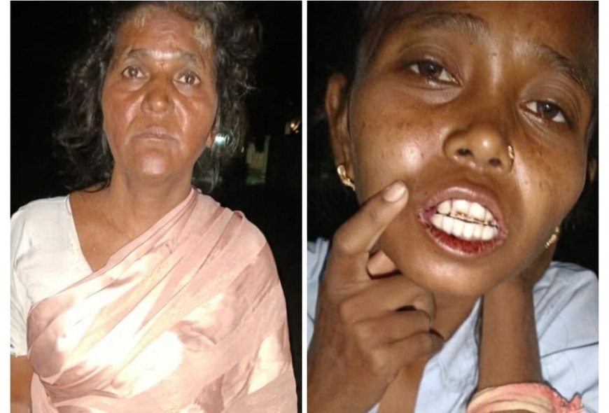 रायपुर के इंद्रप्रस्थ BSUP कॉलोनी में महिला और उसकी मां से मारपीट का आरोप
