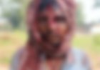 धमतरी में भालुओं का हमला, 4 भालुओं ने 2 युवकों को बनाया निशाना, एक की हालत नाजुक
