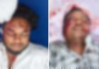 भोरमदेव रोड पर दो बाइक की आमने-सामने भिड़ंत, एक की मौत, दो घायल