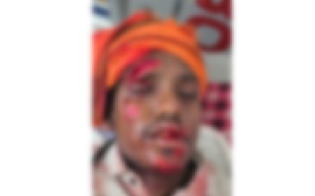 जर्जर पुल के गड्ढे में बाइक अनियंत्रित, युवक गंभीर घायल; हायर सेंटर रेफर