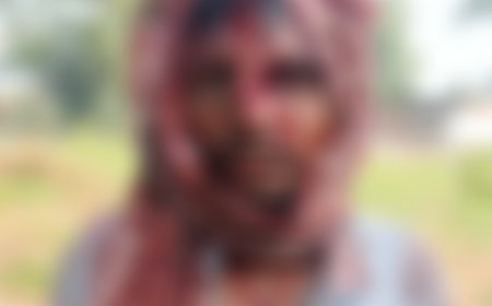धमतरी में भालुओं का हमला, 4 भालुओं ने 2 युवकों को बनाया निशाना, एक की हालत नाजुक