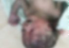 गौरेला जिला अस्पताल के टॉयलेट में मिला मृत नवजात, CCTV फुटेज से संदिग्धों की तलाश
