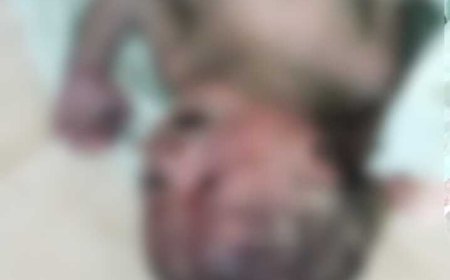 गौरेला जिला अस्पताल के टॉयलेट में मिला मृत नवजात, CCTV फुटेज से संदिग्धों की तलाश