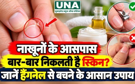 नाखूनों के आसपास बार-बार निकलती है स्किन? जानें हैंगनेल से बचने के आसान उपाय
