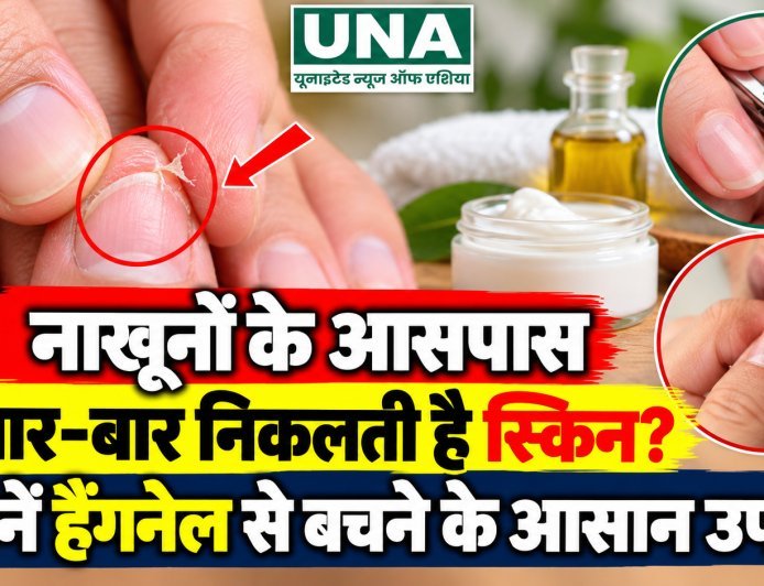 नाखूनों के आसपास बार-बार निकलती है स्किन? जानें हैंगनेल से बचने के आसान उपाय