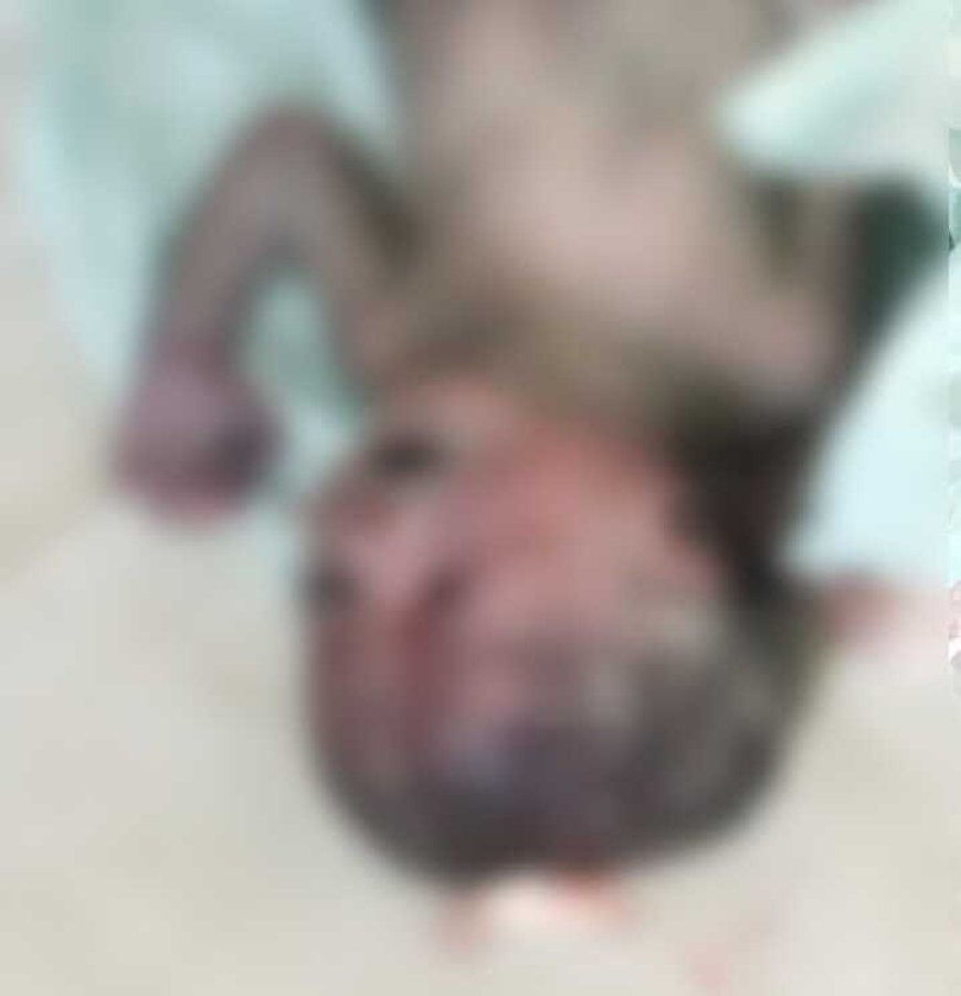 गौरेला जिला अस्पताल के टॉयलेट में मिला मृत नवजात, CCTV फुटेज से संदिग्धों की तलाश