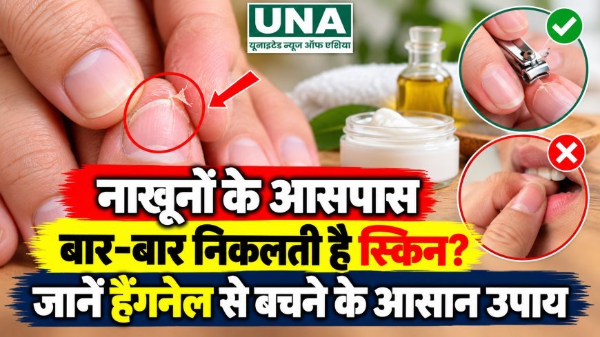 नाखूनों के आसपास बार-बार निकलती है स्किन? जानें हैंगनेल से बचने के आसान उपाय